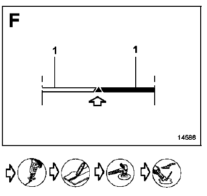 Remplacement partiel supérieur